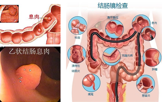 經(jīng)常放屁是在“排毒”？或許“根源”在腸道！