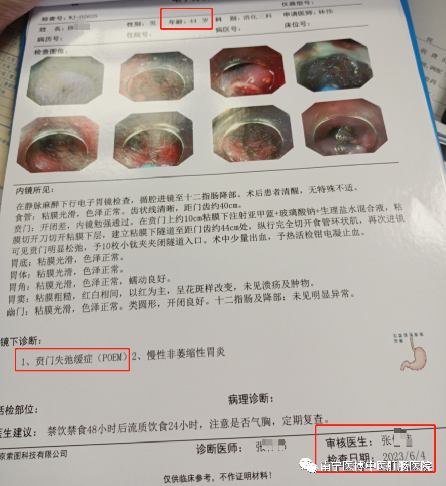   【新技術(shù)】南寧醫(yī)博醫(yī)院成功開(kāi)展首例賁門(mén)失弛緩癥poem手術(shù)