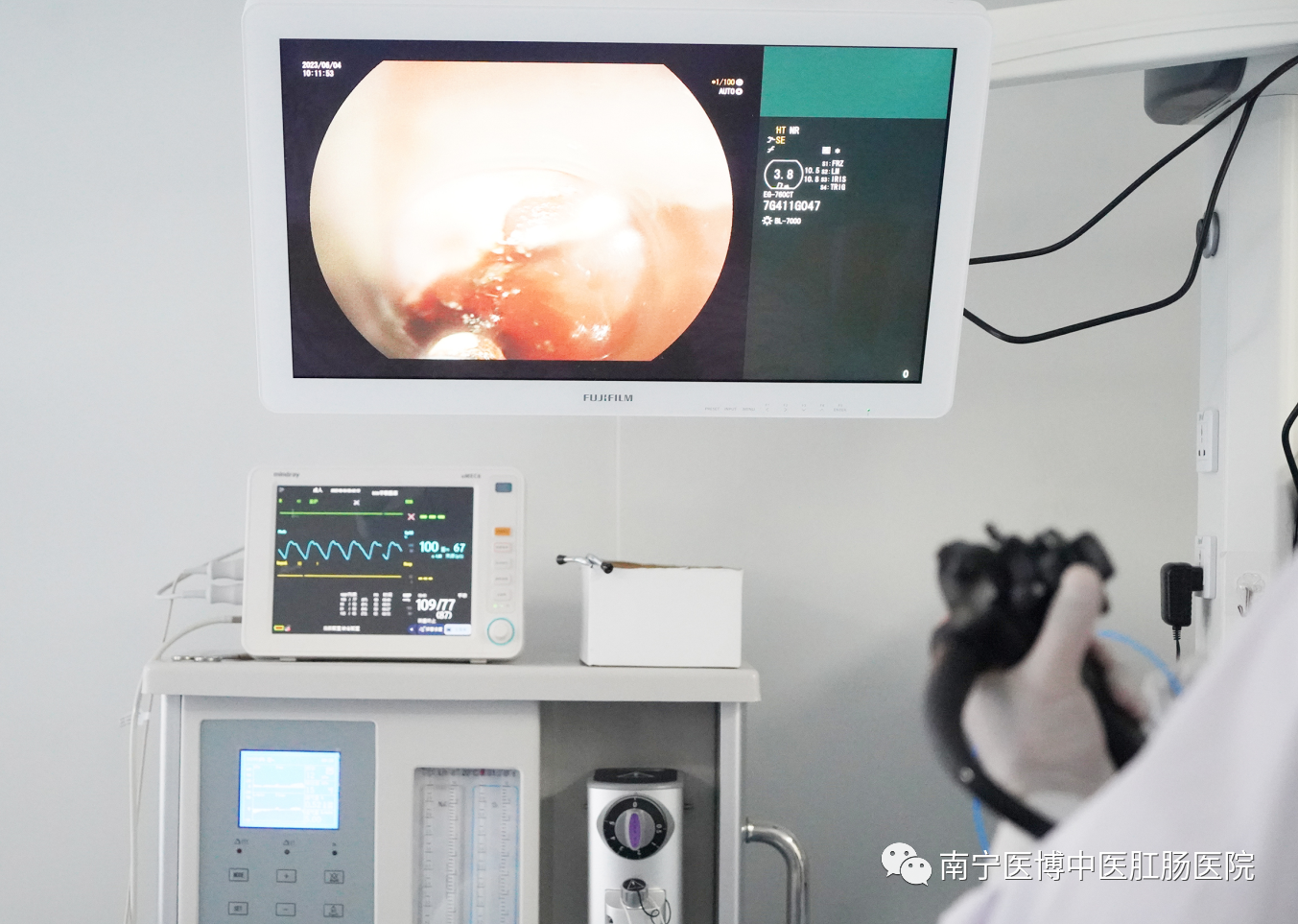   【新技術(shù)】南寧醫(yī)博醫(yī)院成功開(kāi)展首例賁門(mén)失弛緩癥poem手術(shù)